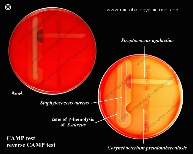 positive  CAMP test, positive reverse CAMP test reaction